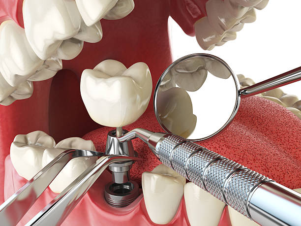 Best Emergency Orthodontic Repairs in Fallston, MD
