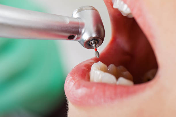 Best Urgent Dental Care for Toothaches in Fallston, MD